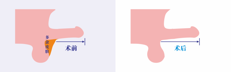 32.png