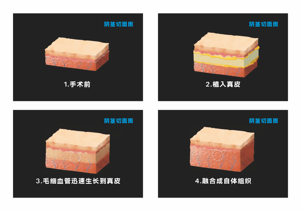352.png